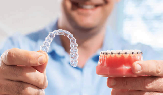 Different Types of Orthodontics Treatments Available