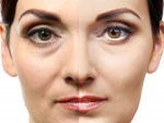 Dubai's Fountain of Youth: Botox for Neck Wrinkles & Platysmal Bands