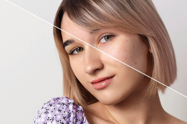 Best Aesthetic Enhancement with BTL Ultra 360 in Marylebone, London