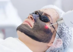 Top Hollywood Peel Treatments