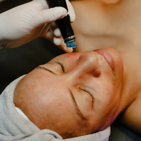 The Ultimate Guide to Best Hydrafacial Treatment In Oman