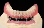 China's Dental Lab Outsourcing: A Growing Trend in Global Dental Care Solutions