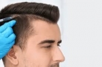 Hair Transplant Trends: What’s New in Dubai’s Cosmetic Scene