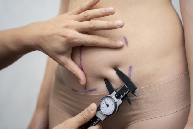 Dubai Laser Liposuction: Choosing the Right Board-Certified Surgeon
