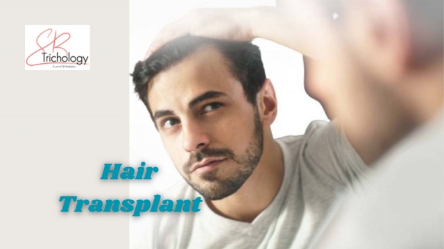 Top Tips for Maintaining the New Hair After a Transplant - SB Trichology