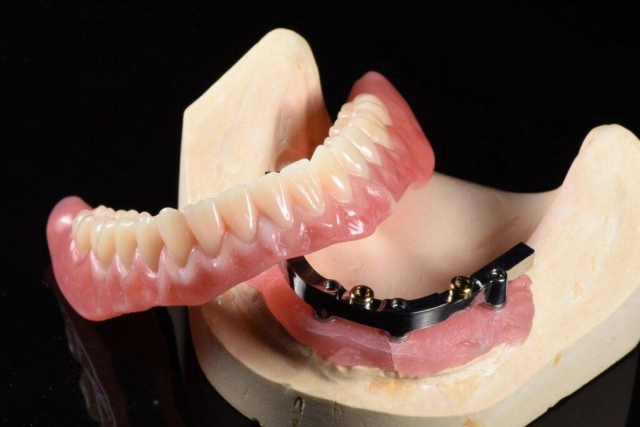 Streamline Your Dental Practice with Chinadentalab: The Leading Outsourced Dental Lab in China