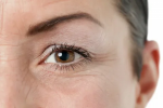The Ultimate Guide to Wrinkle Removal Treatments in Dubai