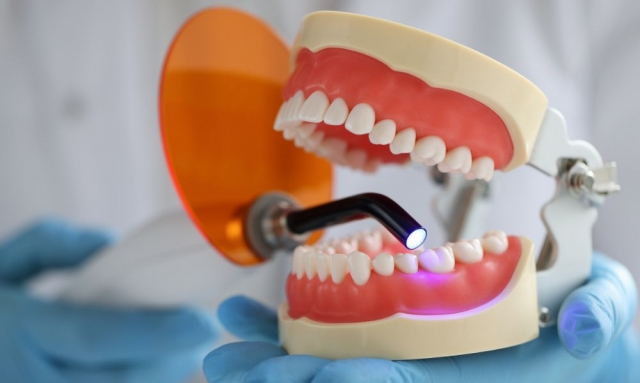 Painless Teeth Fillings Transforming Your Dental Experience