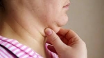 The Best Exercises and Treatments to Eliminate Neck Fat