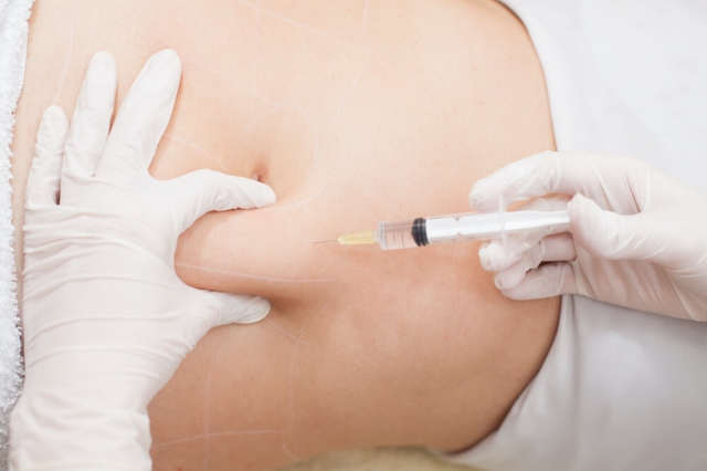 What Are the Benefits of Fat Melting Injections in Dubai? Expert Tips and Insights