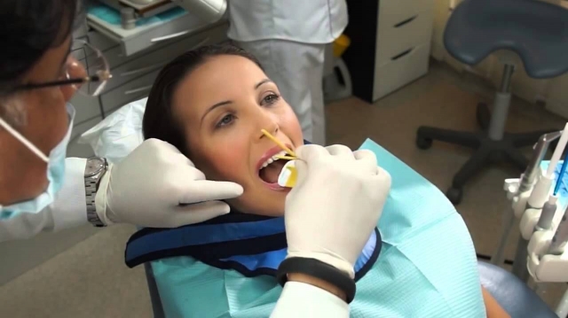 How Do Tooth Filling Prices Compare Across Clinics in Dubai? Tips for Finding the Best Deal