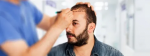 The Future of Hair Restoration: Sharjah’s Best Clinics