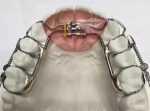 The Ultimate Guide to Outsourcing Dental Lab Work to China with Chinadentalab