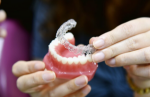 Achieving a Confident Smile with Clear Aligners