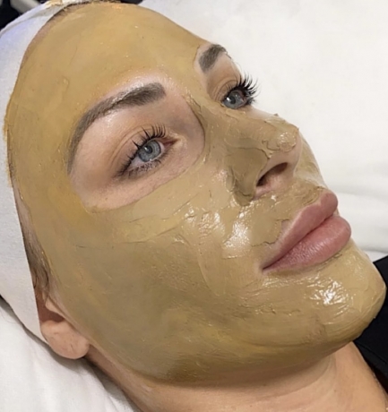 Cosmelan Peel Before and After: What to Expect