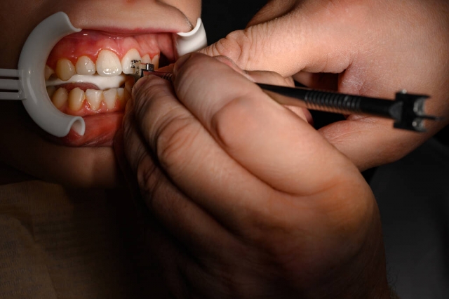 Help Your Child Achieve a Healthy Smile with Braces 