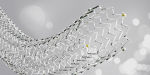 Peripheral Drug-Eluting Stents Market Size and Growth Forecast : Top Manufacturers