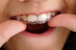 5 Signs You or Your Child Might Need Invisalign