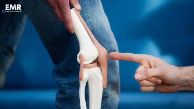El Crecimiento del Mercado de Reparación de Cartílago de Rodilla: Perspectivas para el Futuro