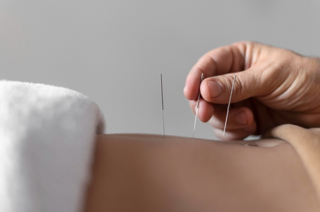 Quick Path to Acupuncture