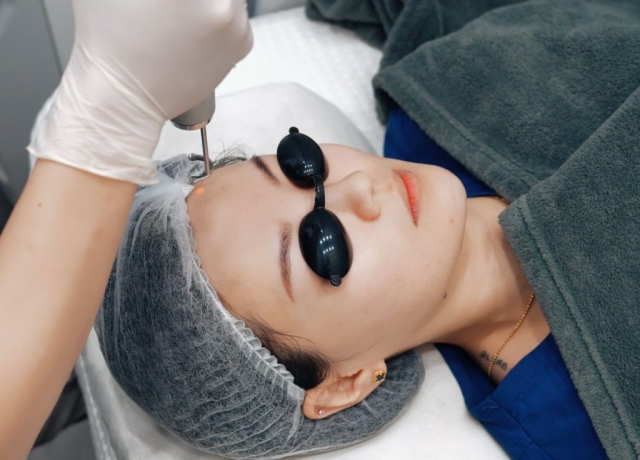 Can Pico Laser Treatment Help with Acne Scars? Expert Insights