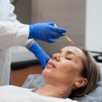 Best Dermadrop Treatment in Marylebone, London