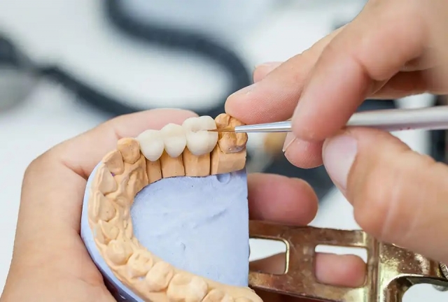 Dental Crown Lab