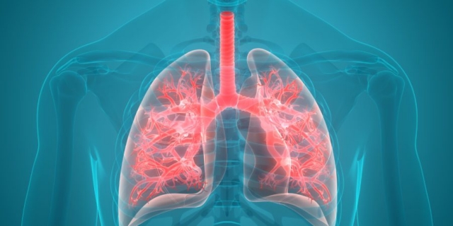 Understanding Idiopathic Pulmonary Fibrosis: An Overview