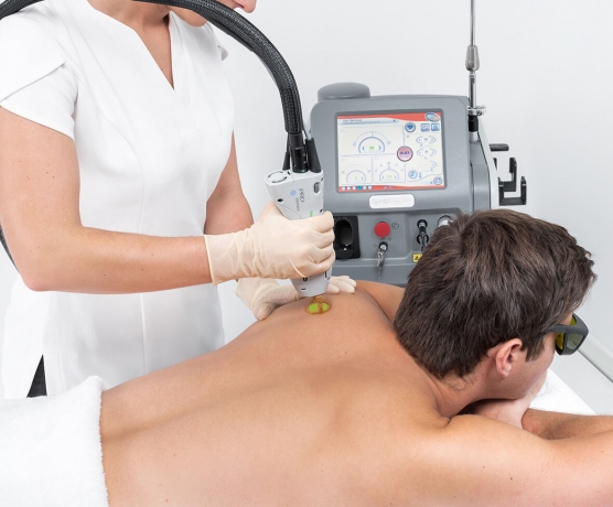 Expert Insights: Is It Haram to Do Laser Hair Removal?