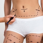 Fat melting injections in Oman