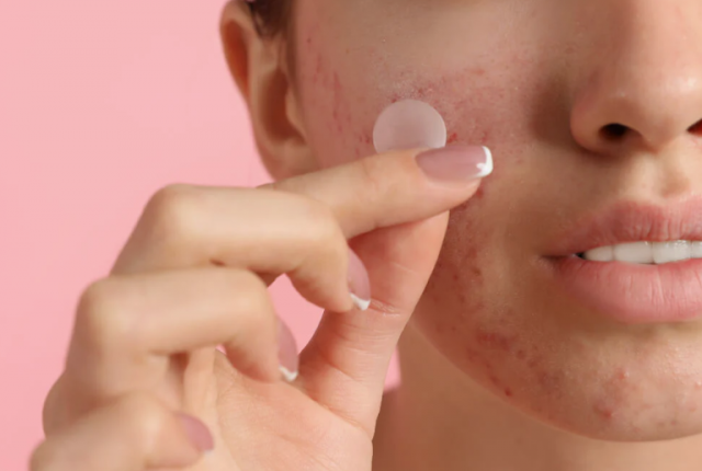 **The Best Pimple Patch for Spot Treatment with Salicylic Acid**