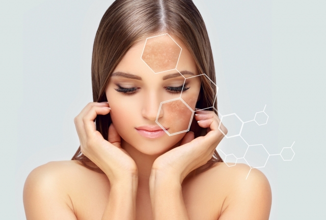 Hyperpigmentation Treatment