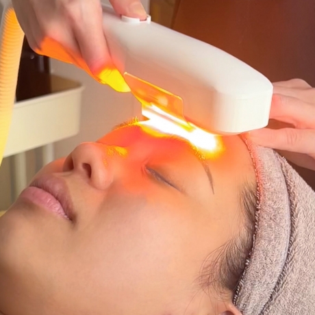 The Impact of Acne Treatment 