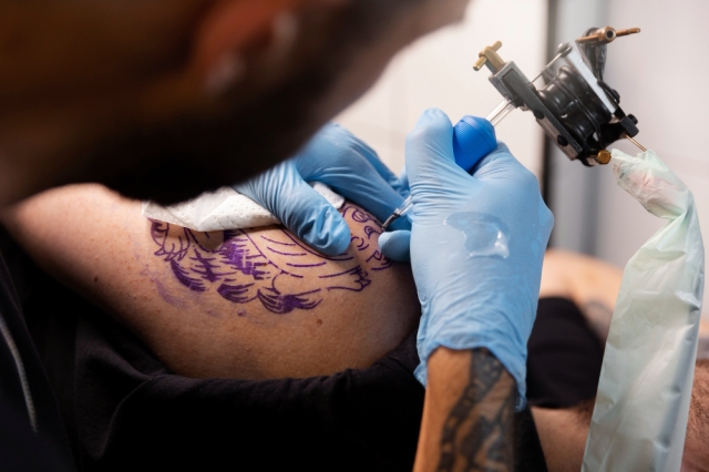 Tattoo Removal with Biolite