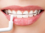 Maintaining Your Smile: A Complete Guide to Dental Retainers in Dubai