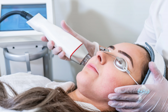 Fractional RF Microneedling: A Personalized Approach to Skincare