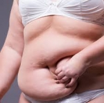 Tummy Tuck : A Culinary Adventure