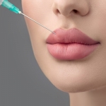 Best Russian Lip Fillers Clinic Muscat