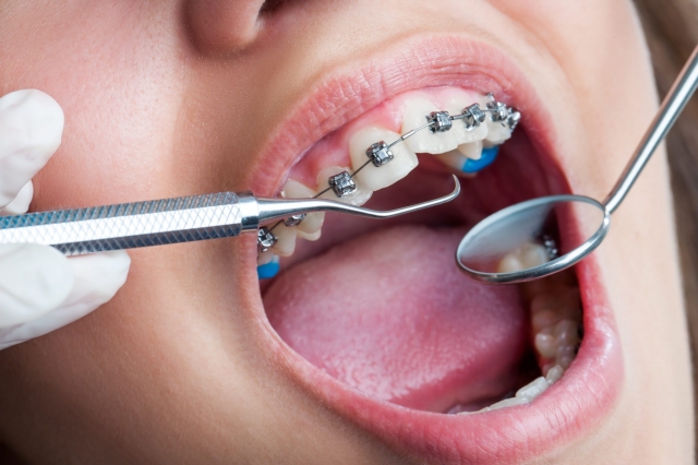 Orthodontic Treatment's Advantages for People of All Ages