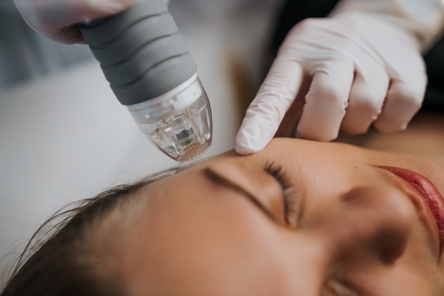 How much does fractional RF microneedling cost in Dubai