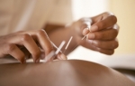 Feel Fresh and Energized – Visit Calgary's Top Acupuncture clinic