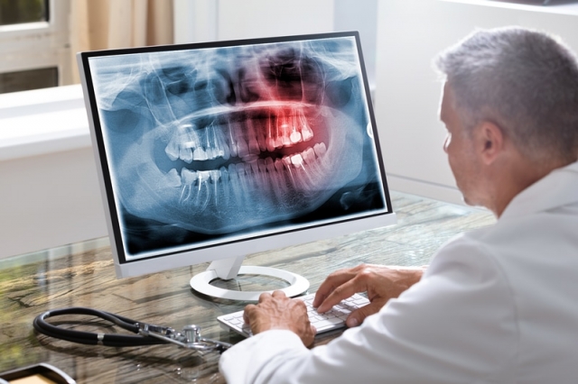 Are Dental Panoramic X-Rays Safe Insights for Dubai Patients