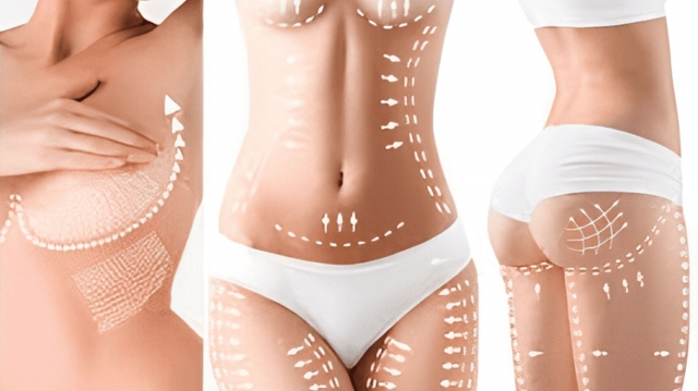 The Best Body Sculpting Procedures for Your Ideal Shape