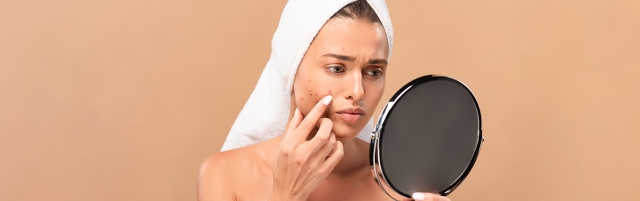 Acne Symptoms & Treatments