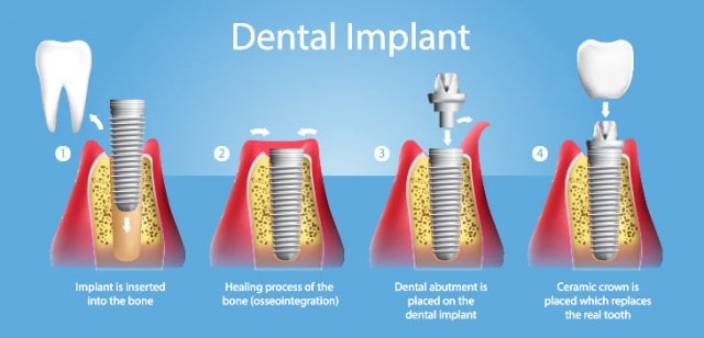 Looking for the Best Dental Clinic in India? Choose Aesthetic Smiles India