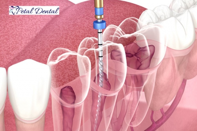 Your Guide to Exceptional Dental Care in Overland Park, KS