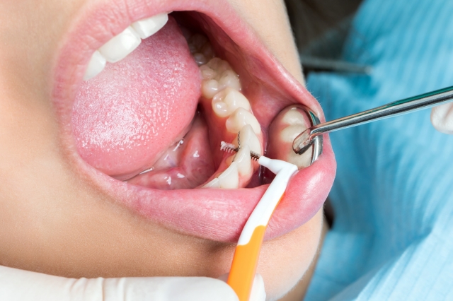 The Importance of Teeth Cleaning for Children: A Parent’s Guide