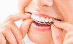 The Benefits of Choosing Invisalign in Bakersfield with Cardall Orthodontics