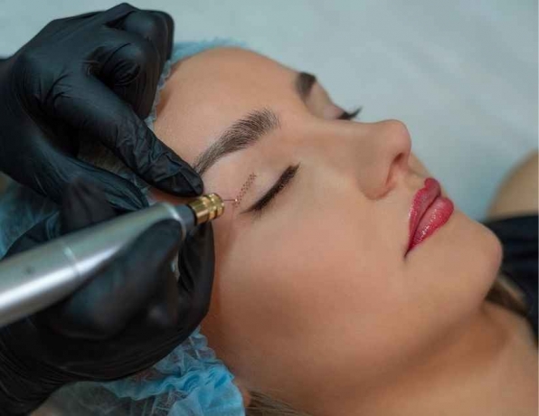 Is Plasma Pen Treatment Permanent?