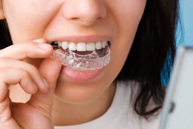 Personalized Dental Retainers in Dubai for Every Need